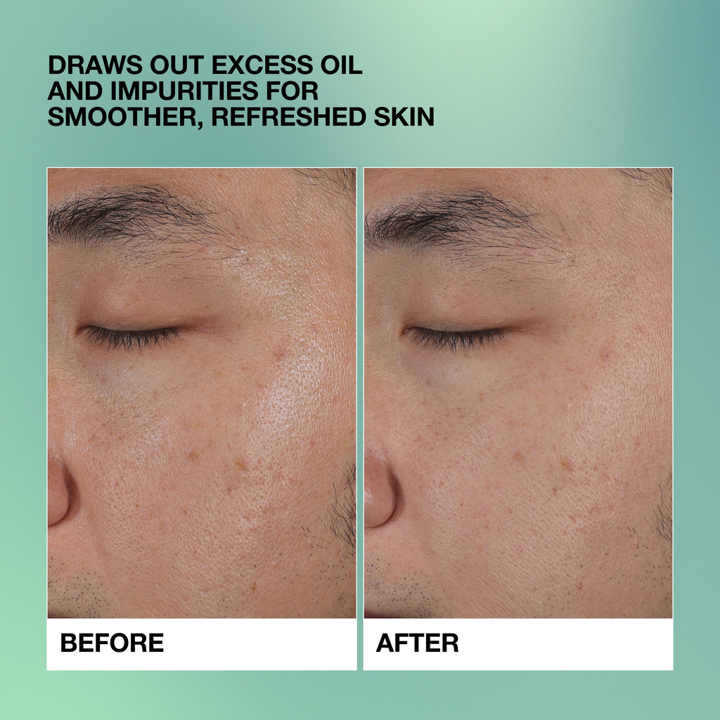 Clear LS Deep Pore Clarifying Clay Mask, 125.0 ml, Model