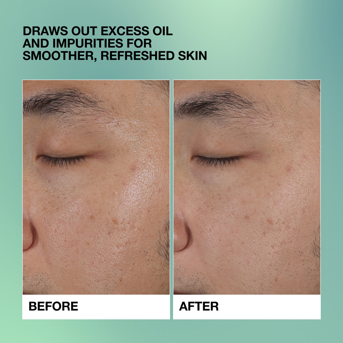 Clear LS Deep Pore Clarifying Clay Mask, 125.0 ml, Model
